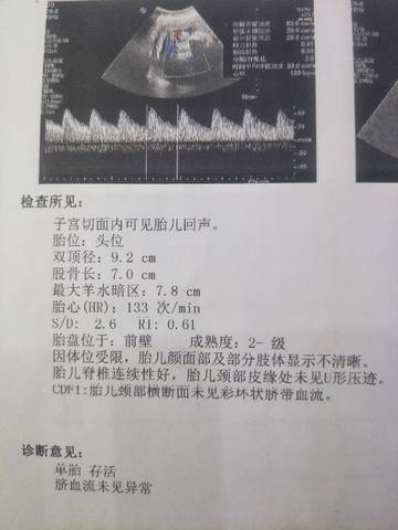 journal_insert_pic_1687242777