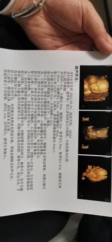 journal_insert_pic_1675601284
