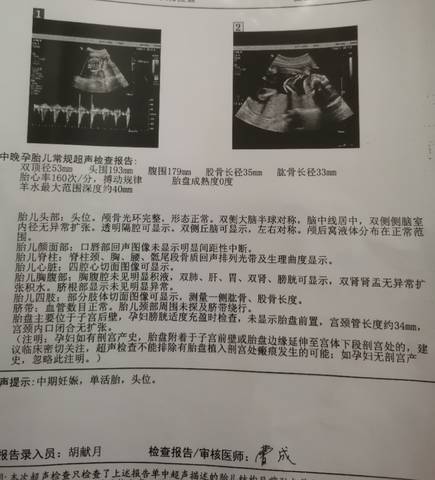 journal_insert_pic_1678092261