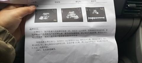 journal_insert_pic_1685262286