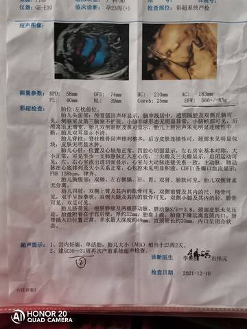 journal_insert_pic_1677356843