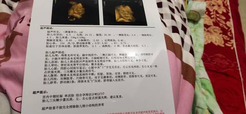 journal_insert_pic_1678632609