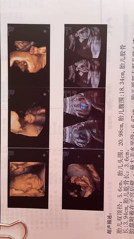 journal_insert_pic_1674223260