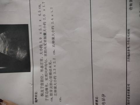 journal_insert_pic_1675025179