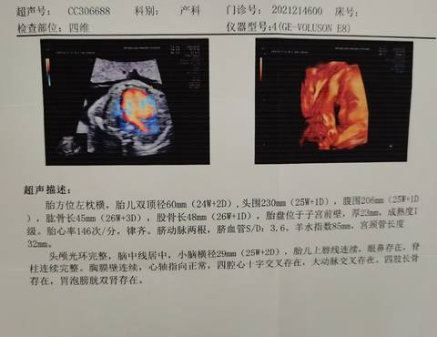 journal_insert_pic_1684589828