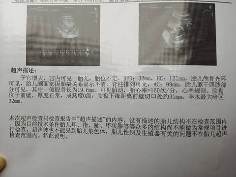 journal_insert_pic_1740814389