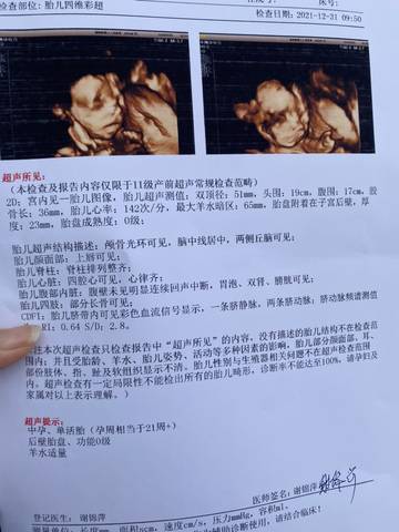journal_insert_pic_1690408315