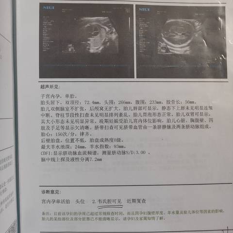 journal_insert_pic_1677423365