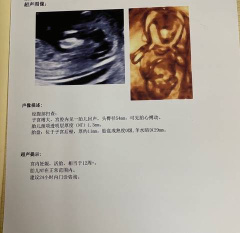 journal_insert_pic_1681605940