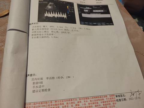 journal_insert_pic_1678685528