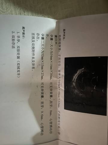journal_insert_pic_1676317433