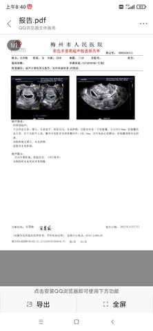journal_insert_pic_1682432757