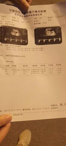 journal_insert_pic_1685885771