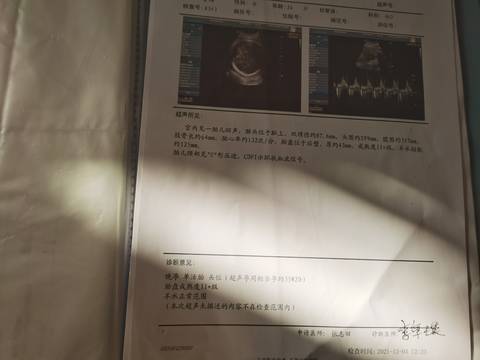 journal_insert_pic_1674798604