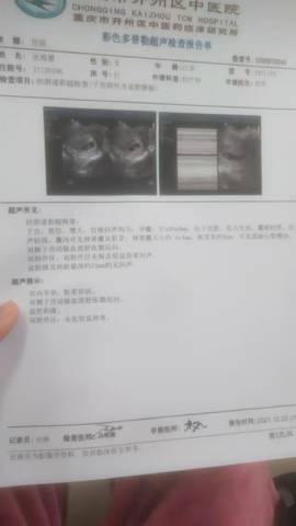journal_insert_pic_1685122886