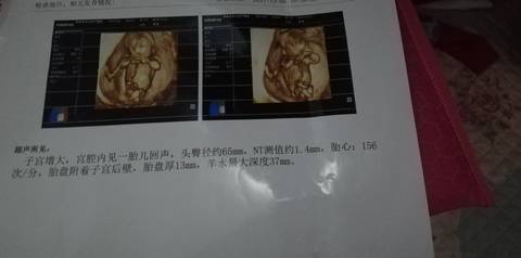 journal_insert_pic_1675095866