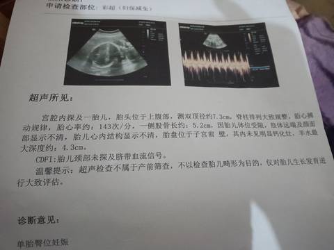 journal_insert_pic_1675004933