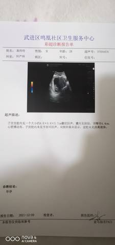 journal_insert_pic_1676585088