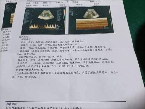 journal_insert_pic_1688825233