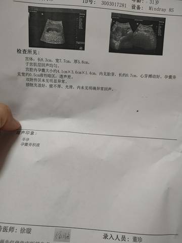journal_insert_pic_1678278835