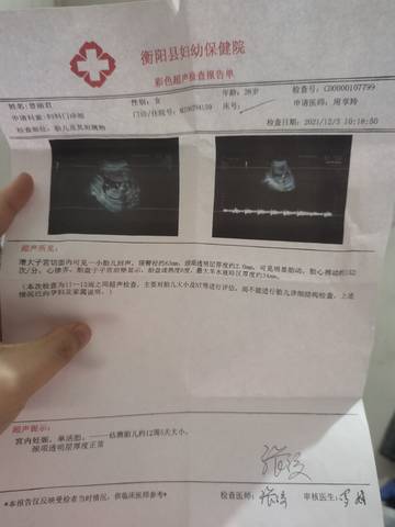 journal_insert_pic_1675026287