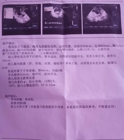journal_insert_pic_1674772316