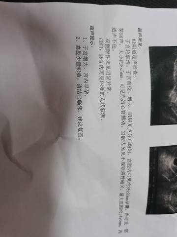 journal_insert_pic_1685524104