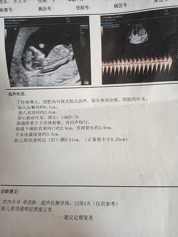 journal_insert_pic_1673397571