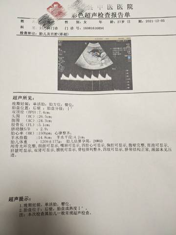 journal_insert_pic_1674631820