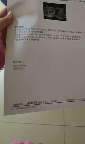 journal_insert_pic_1689017727