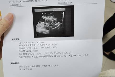 journal_insert_pic_1675672485
