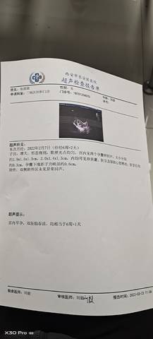 journal_insert_pic_1740838642