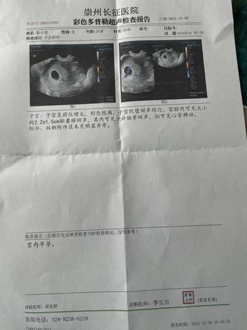 journal_insert_pic_1690302891