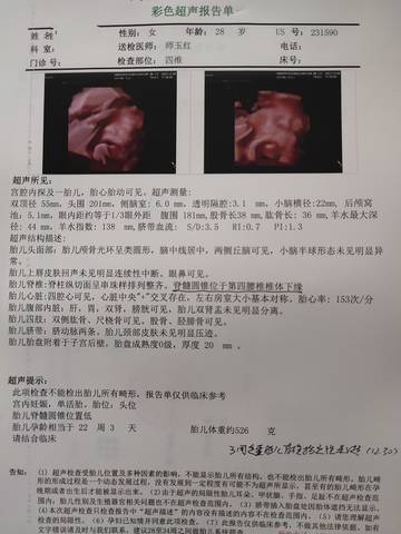 journal_insert_pic_1677292848