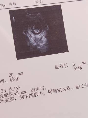 journal_insert_pic_1686287681