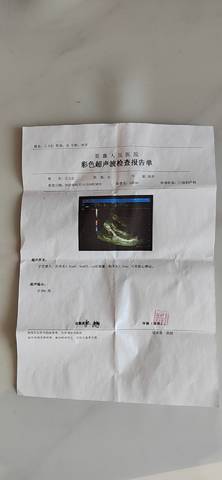 journal_insert_pic_1719520519