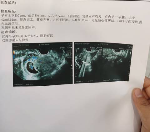 journal_insert_pic_1683742537