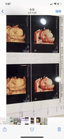 journal_insert_pic_1686440180