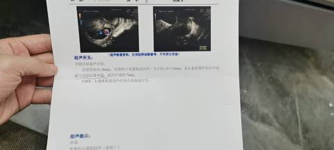 journal_insert_pic_1687223527