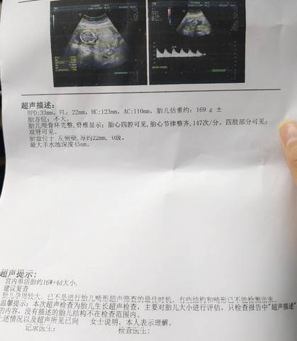 journal_insert_pic_1685757557