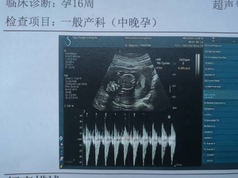 journal_insert_pic_1676552518