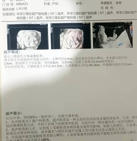 journal_insert_pic_1684315264