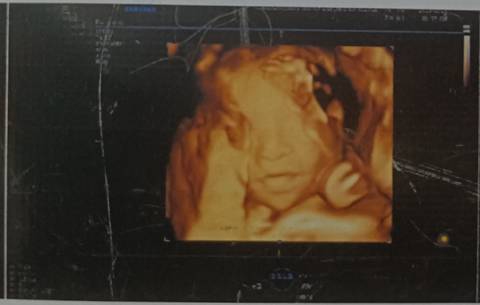 journal_insert_pic_1685476014