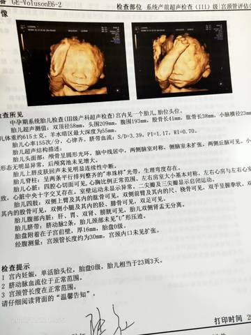journal_insert_pic_1684327752