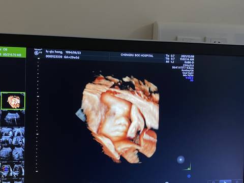 journal_insert_pic_1676067244