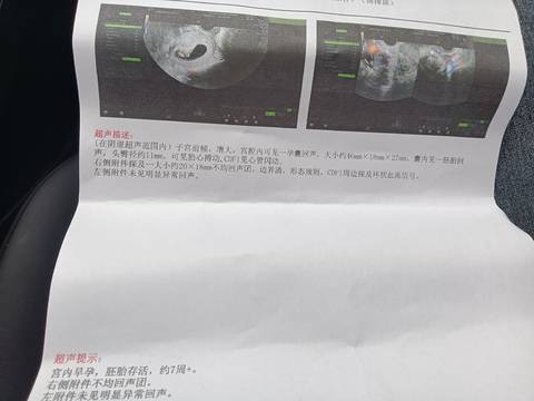 journal_insert_pic_1690019246