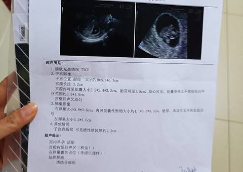 journal_insert_pic_1675723951