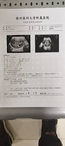 journal_insert_pic_1689497153