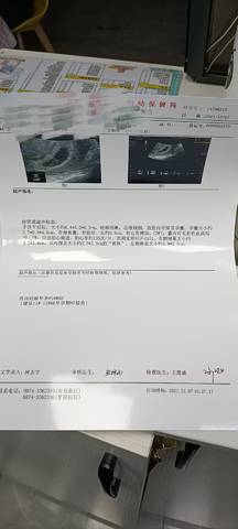 journal_insert_pic_1677495272