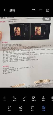 journal_insert_pic_1674725215